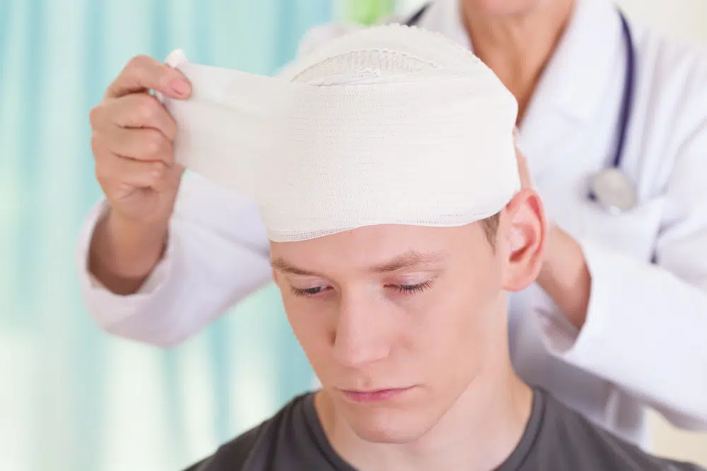 Man with Head Injury Photo of Man with Head Injury