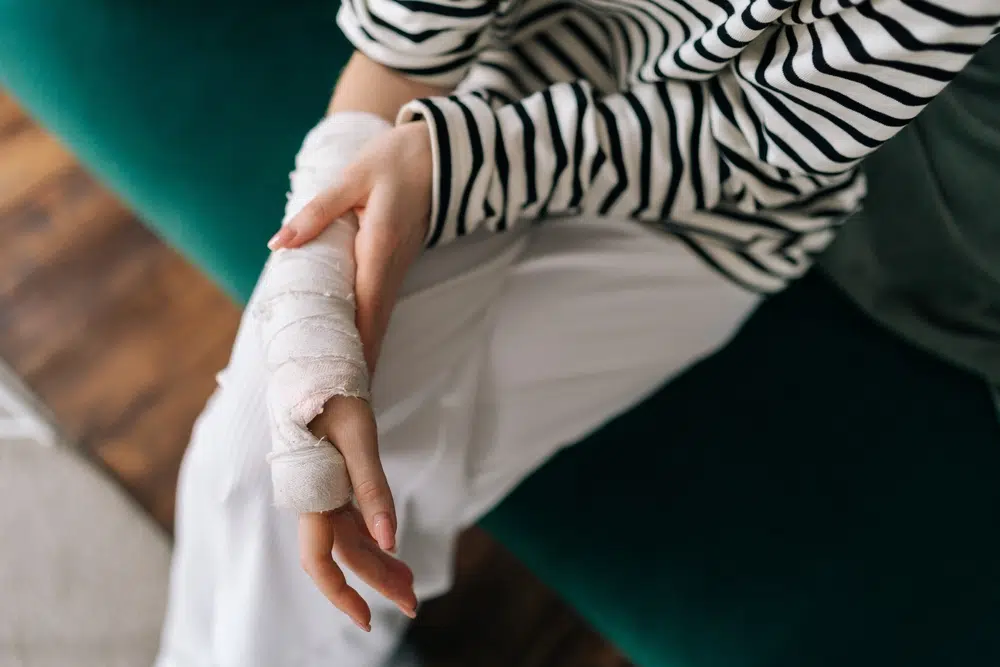 Photo of Injured Hands